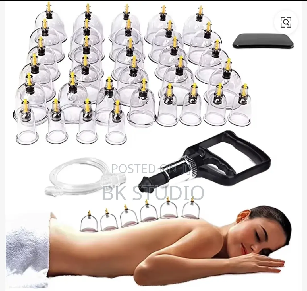 Cupping Therapy