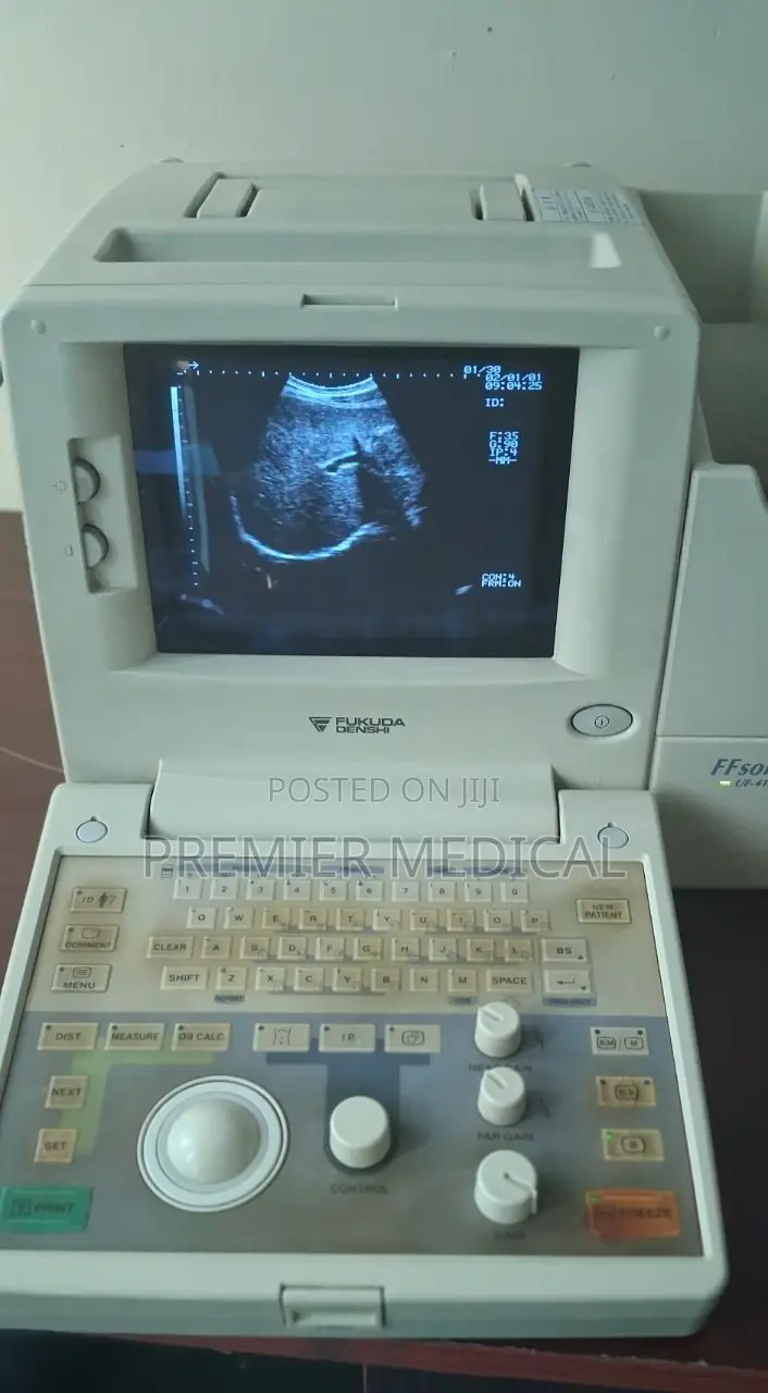 Fukuda Ultrasound Machine