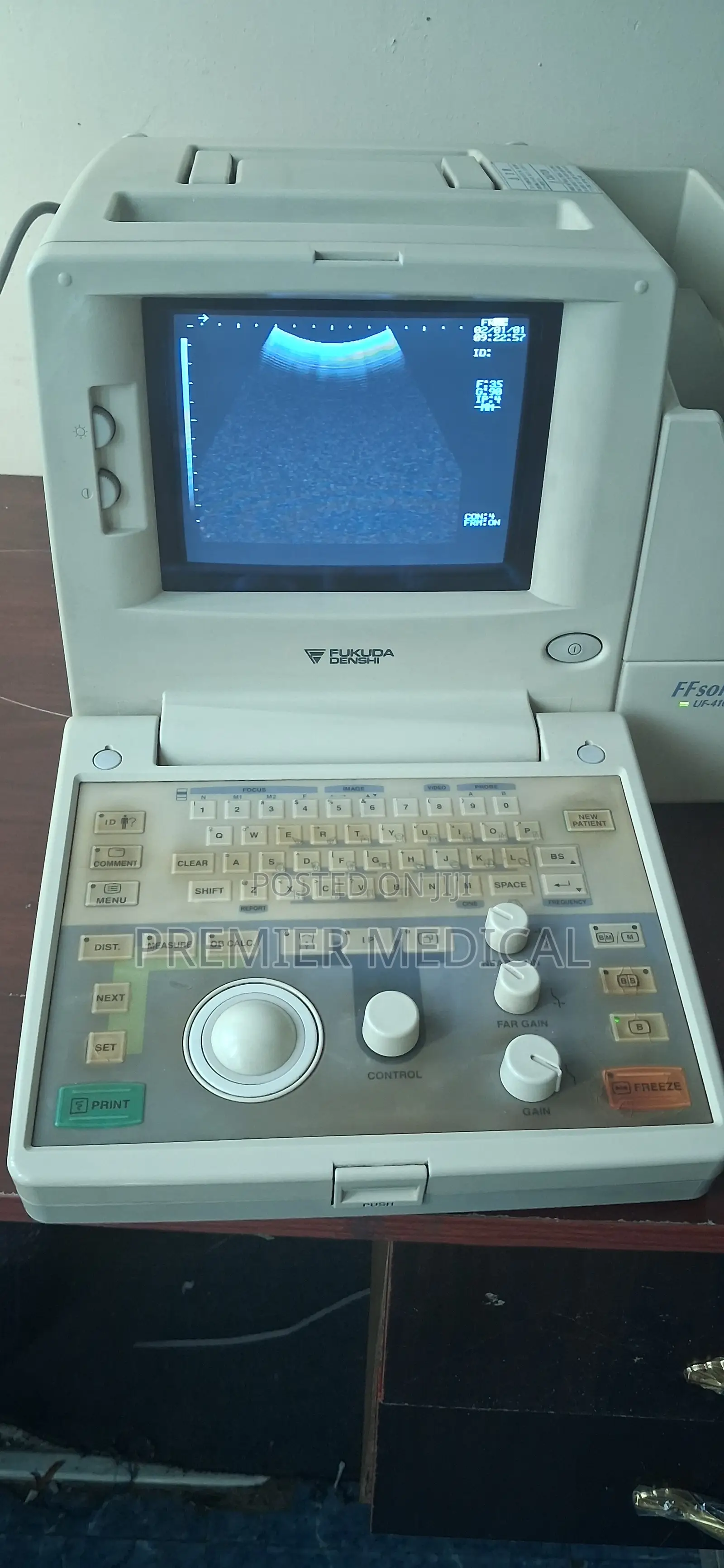 Fukuda Ultrasound Machine