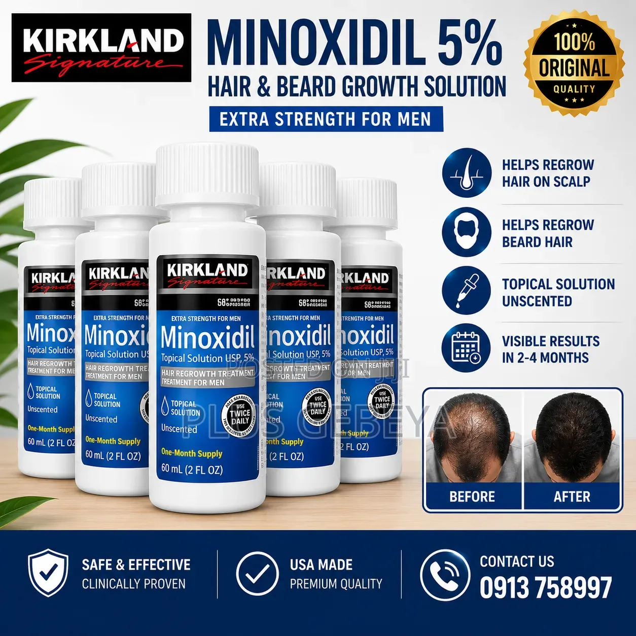 Minoxidil 5% Hair Beard Growth Solution 60ml