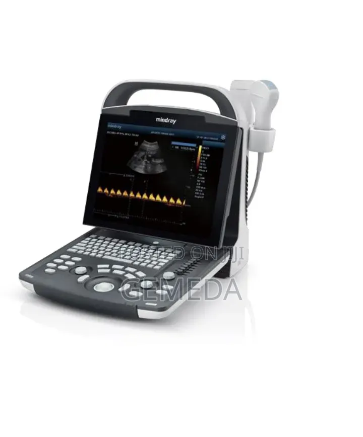 Black and White Mindray Ultrasound. Machine
