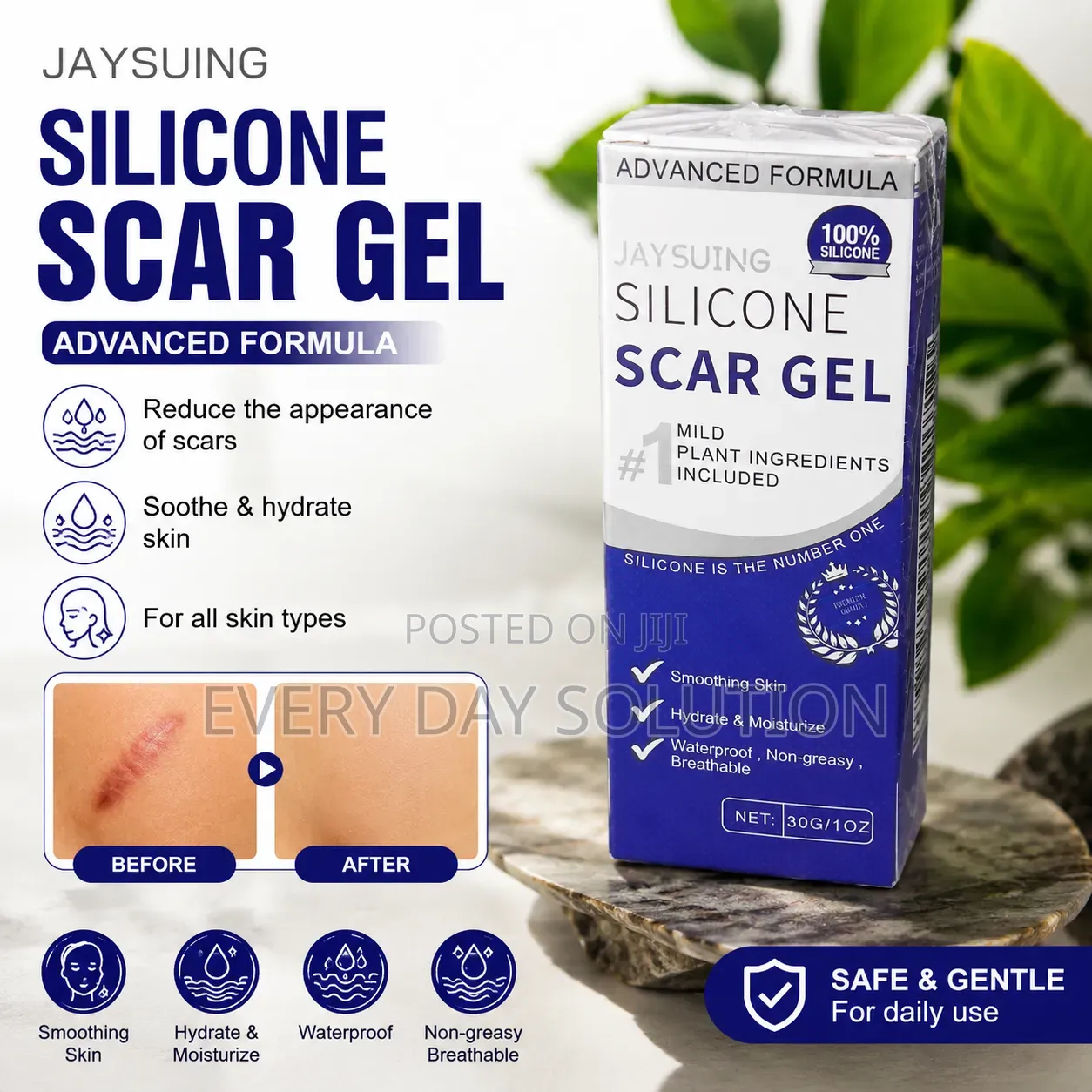 Silicone Scar Gel 30g – የጠባሳ ገጽታን ለመቀነስ የቆዳ እንክብካቤ