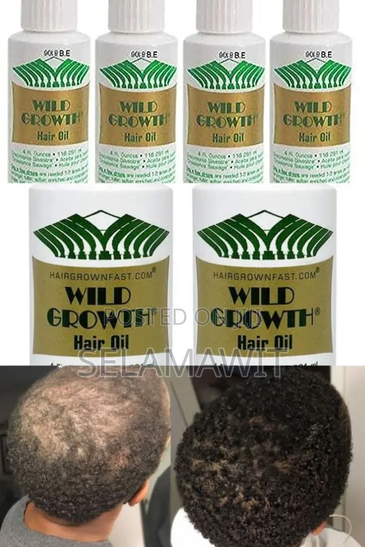 Wild Growth Hair Oil