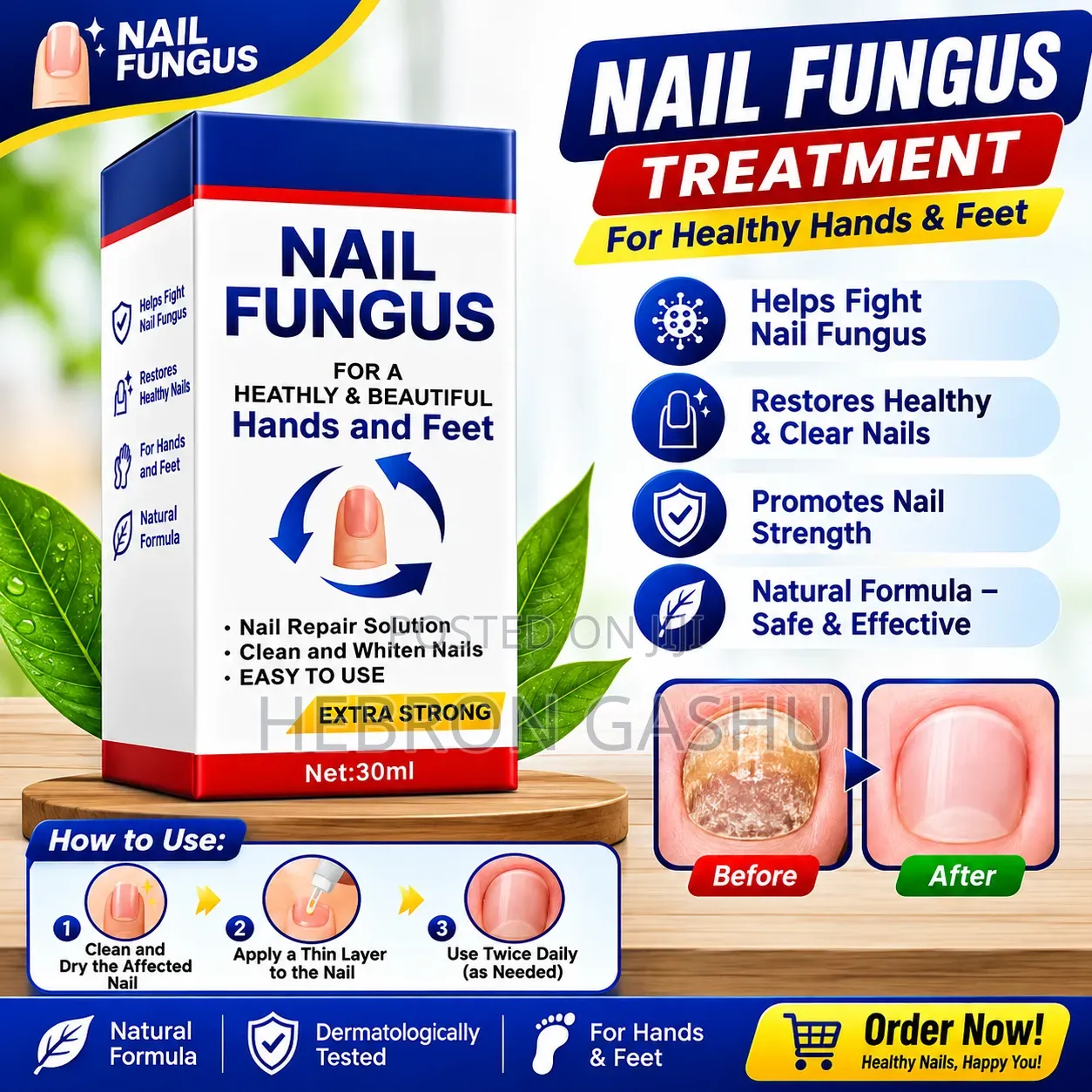 Extra Strong Nail Fungus Treatment 30ml | ለእጅና ለእግር ጥፍር እንክብካቤ