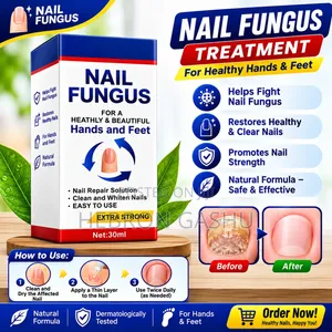Extra Strong Nail Fungus Treatment 30ml | ለእጅና ለእግር ጥፍር እንክብካቤ