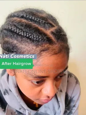 Hairgrow Minoxidil