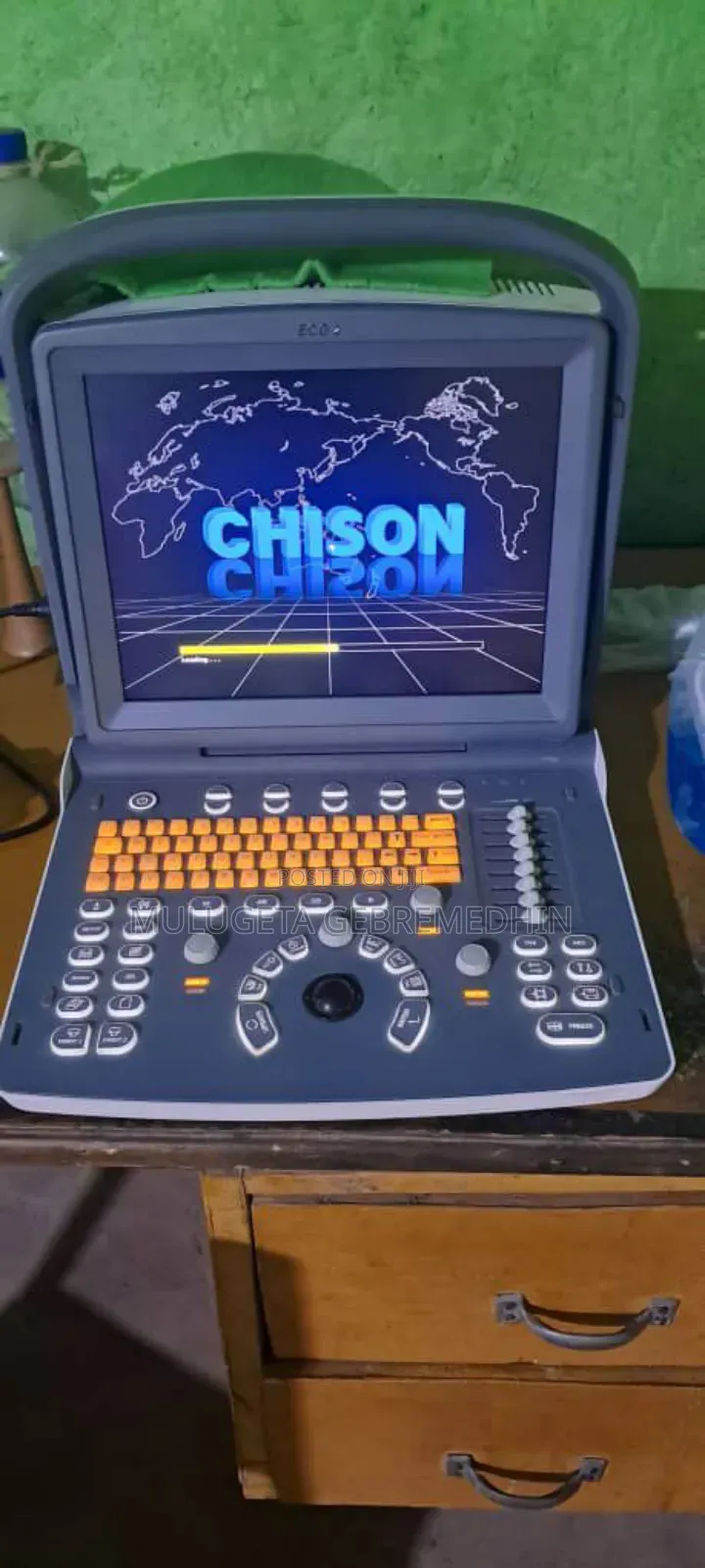 Chison Eco 2 Ultrasound for Sale