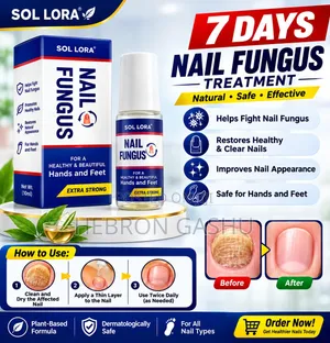 Nail Fungus Treatment – የጥፍር ፈንገስ ማከሚያ 30ml