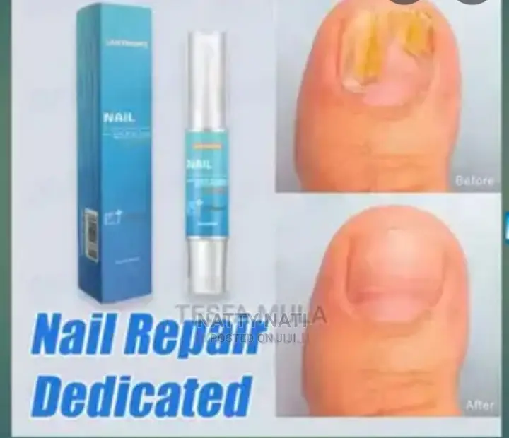 Lanthome Nail Repair