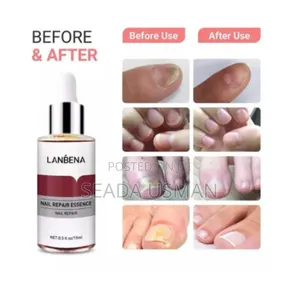 Nail Repair Essence