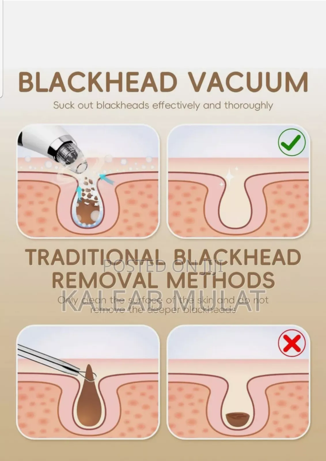 VACUUM Blackhade Remover