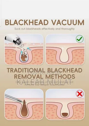 VACUUM Blackhade Remover