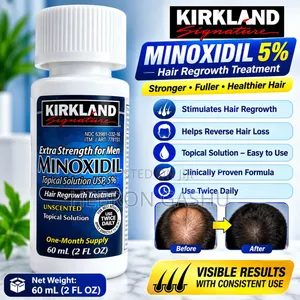 Kirkland Signature Minoxidil 5% – 60mL