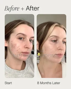 Topicals Faded Brightening Clearing Serum