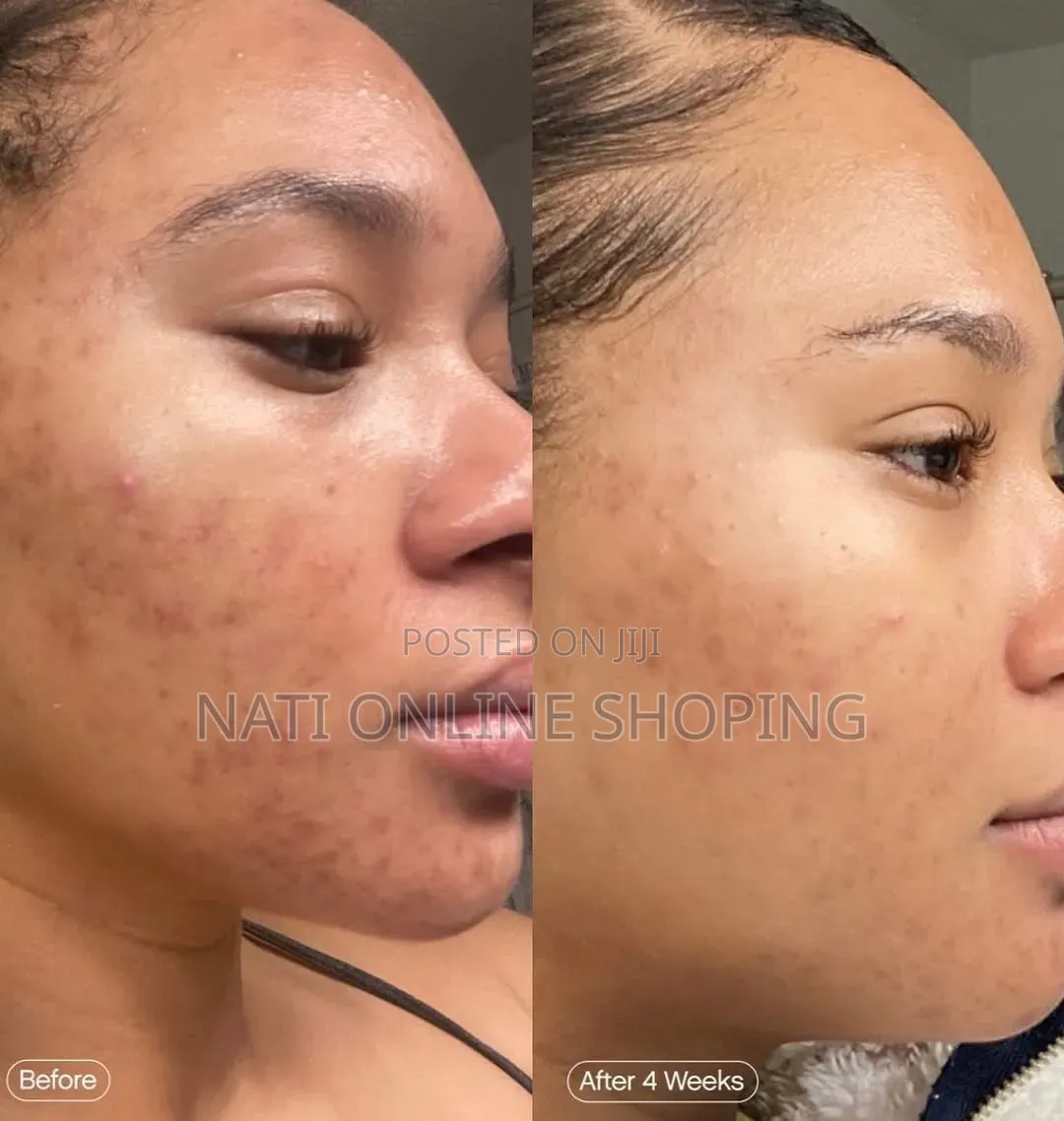 Topicals Faded Brightening Clearing Serum