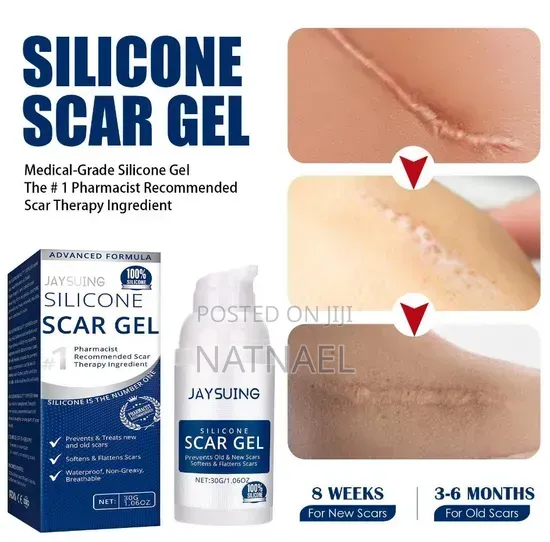 Silicone Scar Gel (የጠበሳ ማጥፊያ)