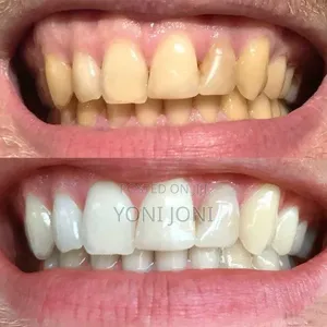 Marvis Teeth Whitening