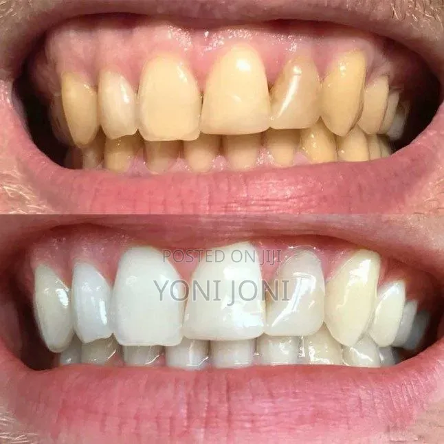 Marvis Teeth Whitening