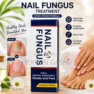 Nail Fungus Nail Treatment – Extra Strong