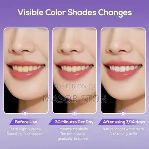 V34 Purple Teeth Whitening Strips