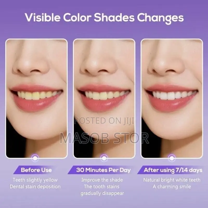 V34 Purple Teeth Whitening Strips