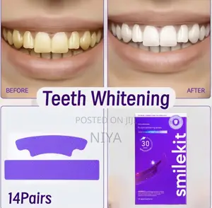 Teeth Whitening Strips