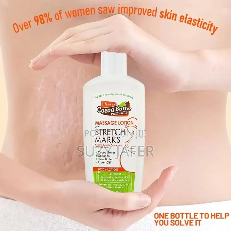 Dissar Stretch Mark Removal Lotion | Non-Greasy Formula