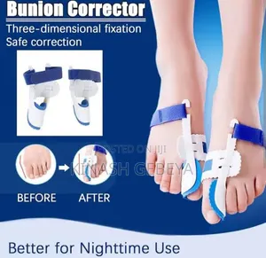 2pcs Bunion Leg Toe Corrector