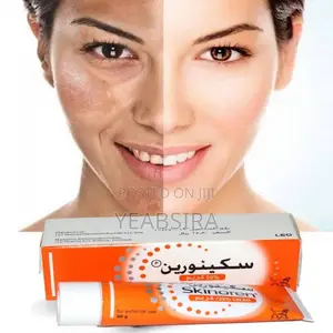 Skinoren 20% Azelaic Cream for Hyperpigmentation and Dark Spots