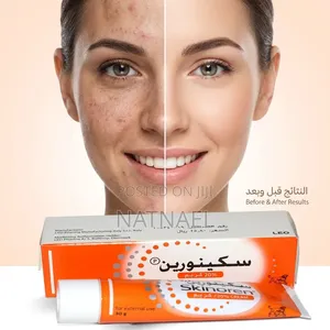 Skinoren® 20% Cream (Azelaic Acid) ለብጉር እና ለቆዳ ቀለም መለዋወጥ/ጥቁረት
