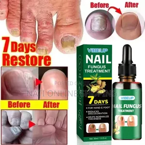 7 Days Nail Fungus Treatment