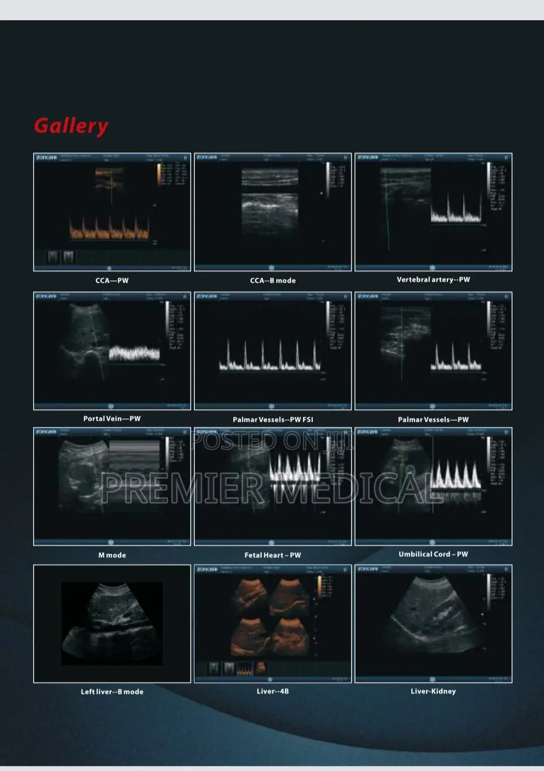 Zoncare Ultrasound Machine