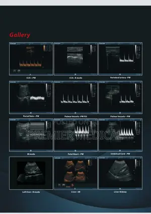 Zoncare Ultrasound Machine