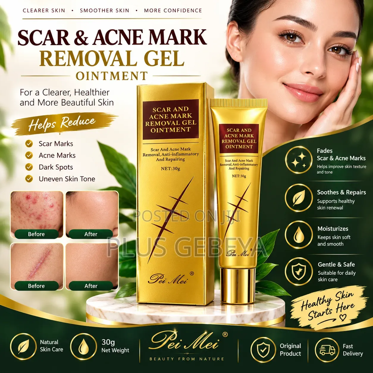 Pei Mei Scar Acne Mark Gel 30g | ለጠባሳ እና የAcne Mark እንክብካቤ