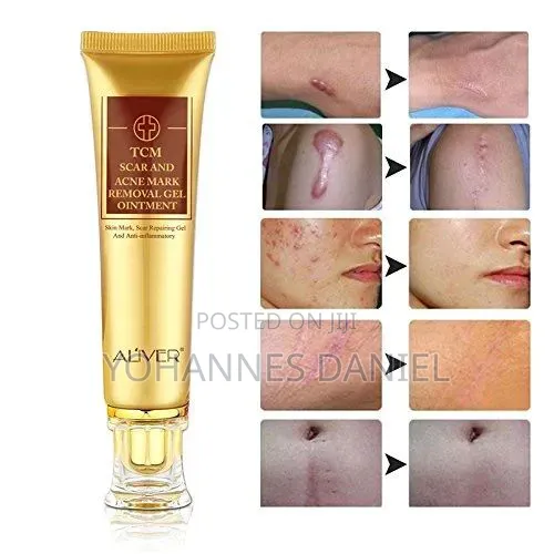 TCM Acne Scar Removal Gel