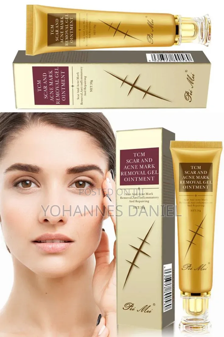 TCm Acne and Scar Removal Gel Ointment