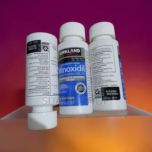 Best Hair Loss Treatment – Minoxidil 5% Dhiirotaaf