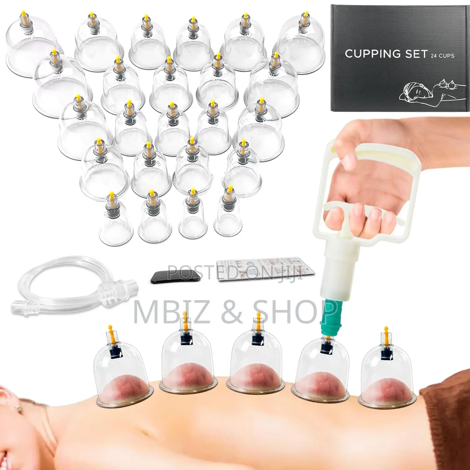 18P Vacuum Cupping