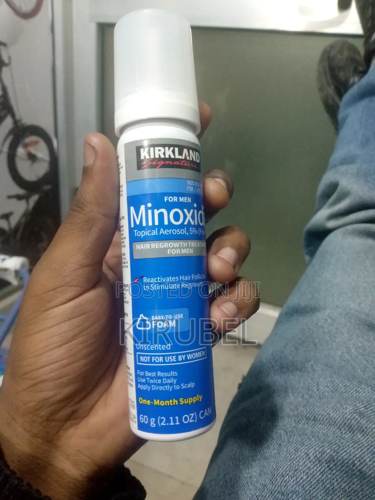በስተት ሌላ ቦታ እንዳትቀባ! Foam Minoxidil 5%
