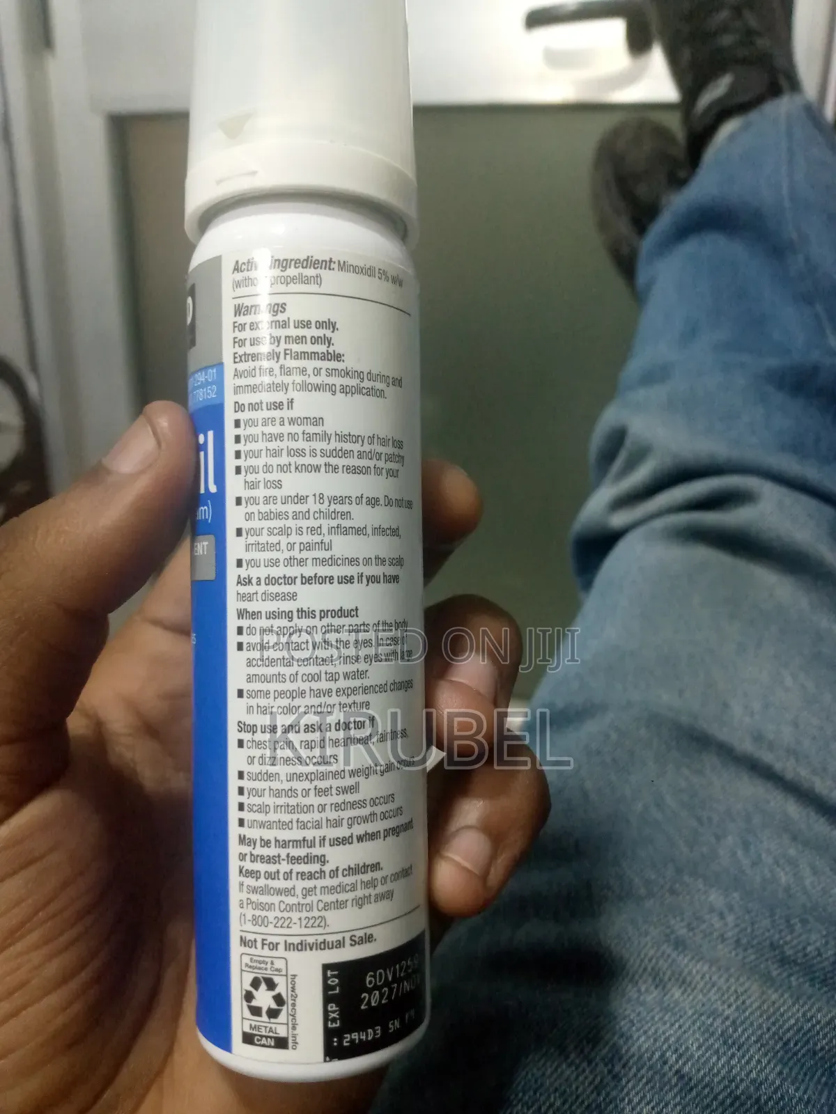 በስተት ሌላ ቦታ እንዳትቀባ! Foam Minoxidil 5%