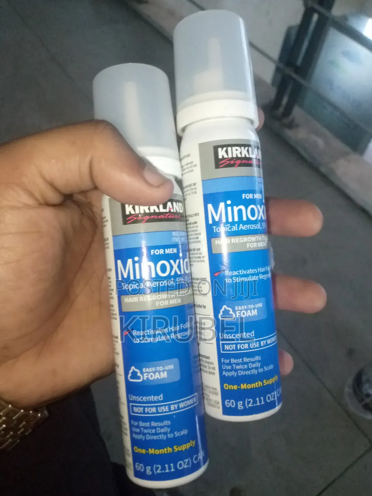 ተመራጩ ፀጉር አብቃይ Foam Minoxidil 5%