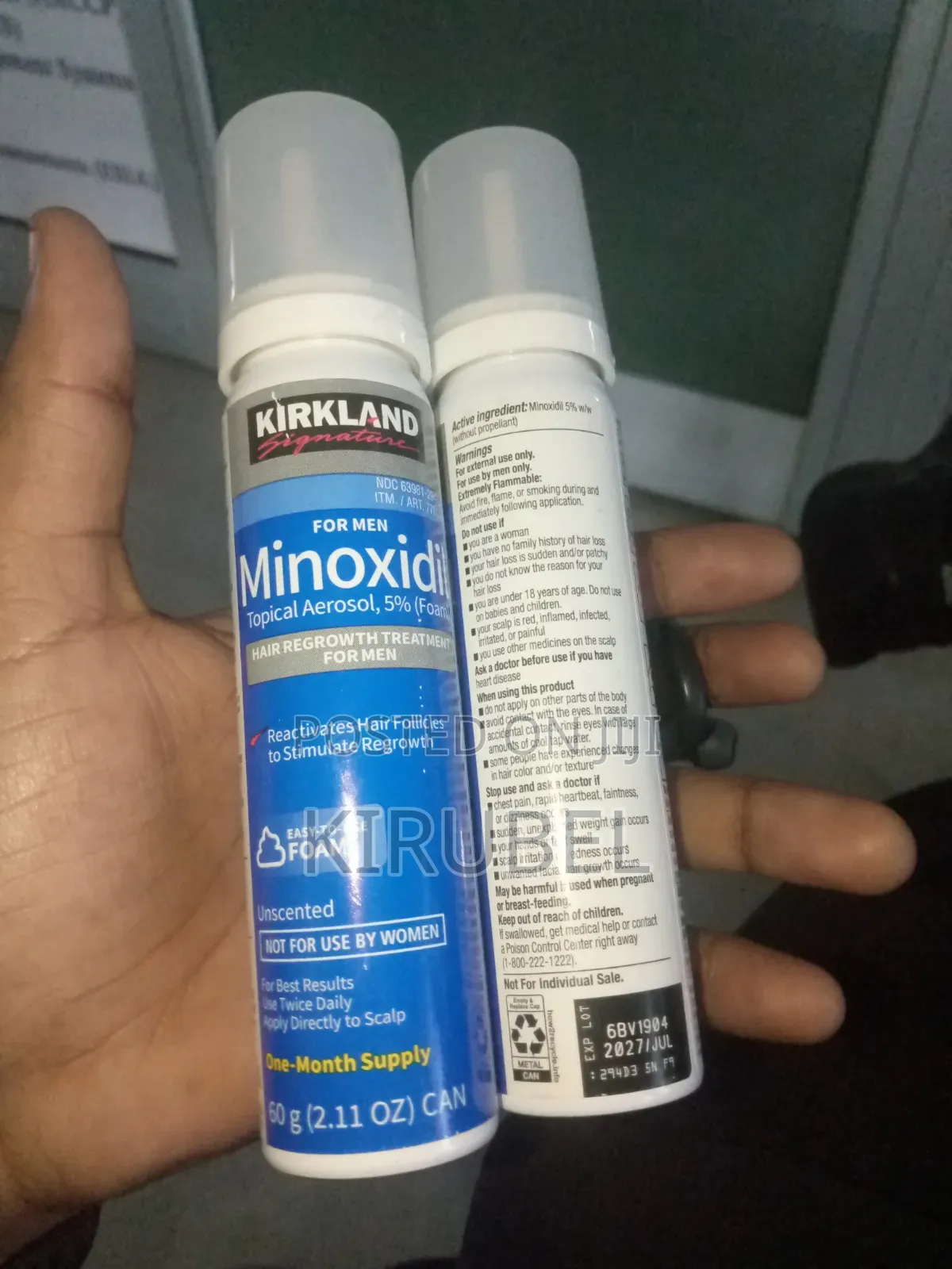 የራስ አናትህ ችግር መፍትሔው ተገኝቷል Foam Minoxidil 5%
