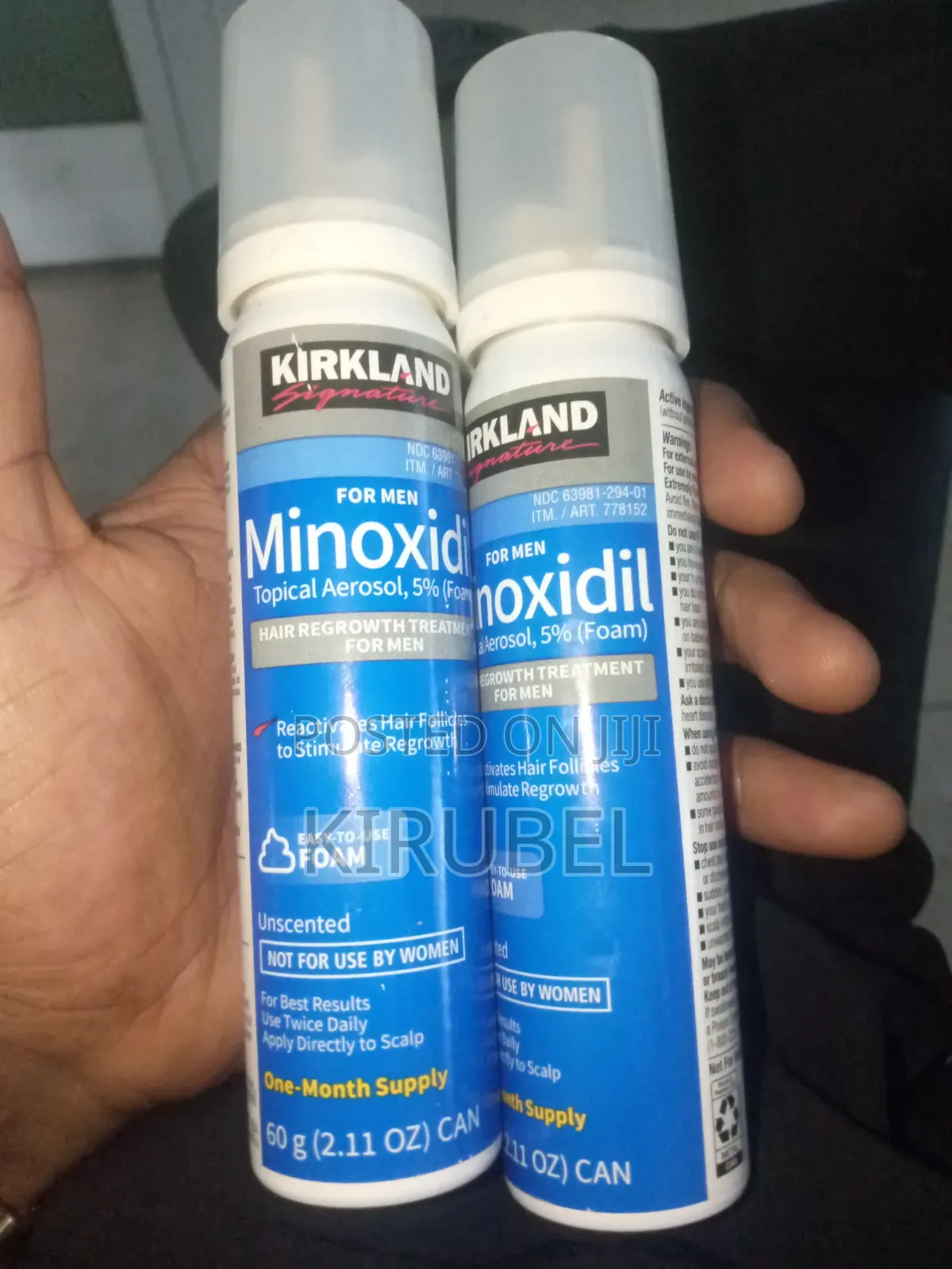 Foam Minoxidil 5% ከ ራሰ በረሀነትን ይታደጋል