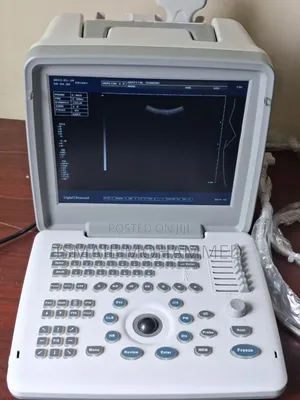 አዲስ ገቢ - የህክምና እቃ (Ultrasound Machine)