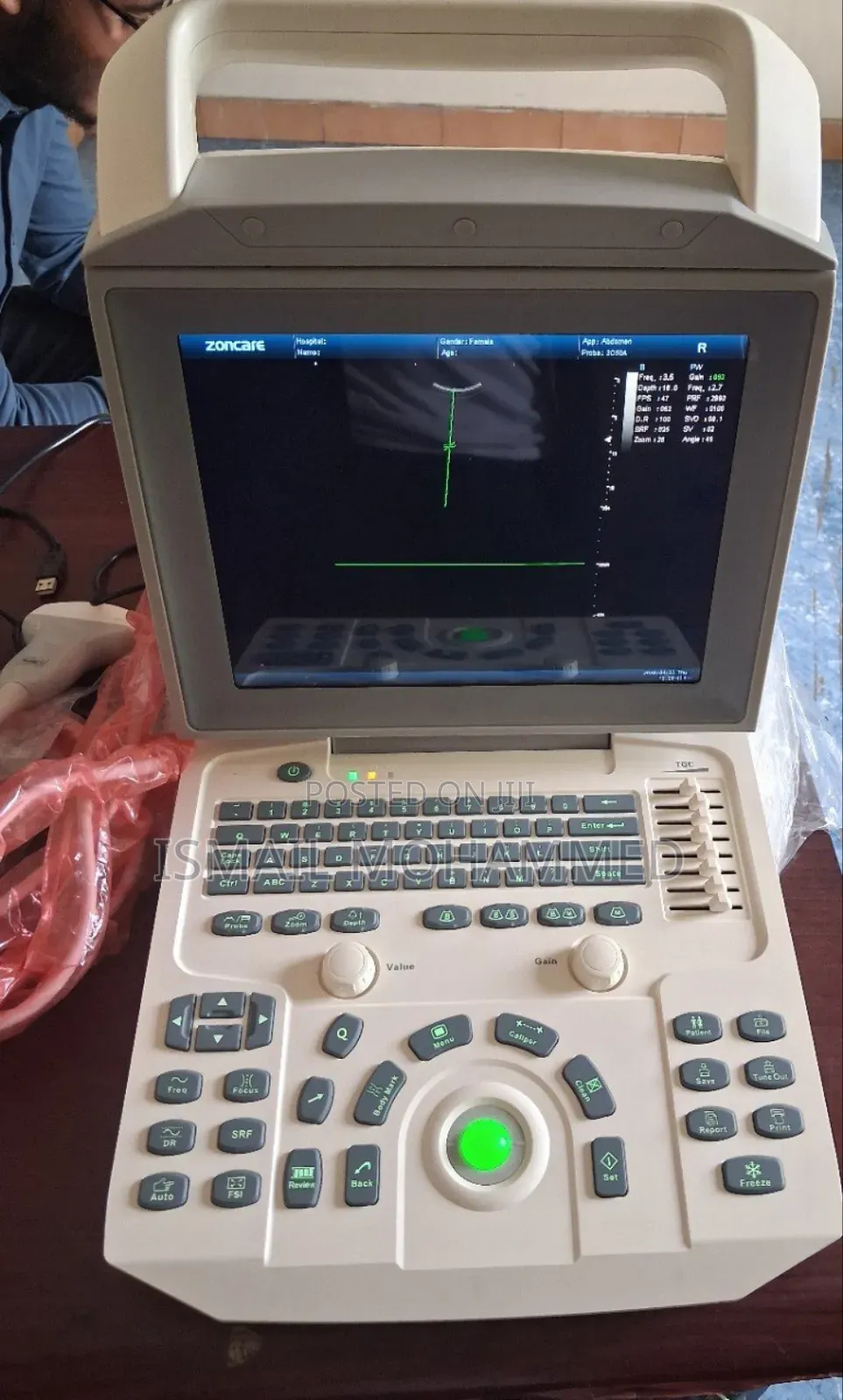 Medical Equipment Store Zoncare I50 Ultrasound Machine