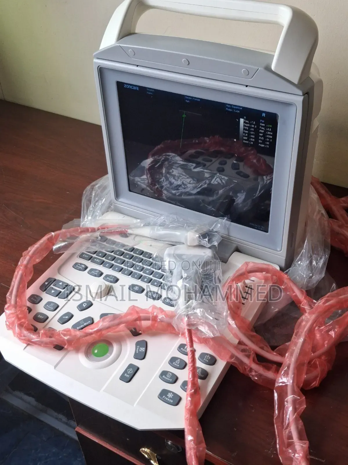 Medical Equipment Store Zoncare I50 Ultrasound Machine