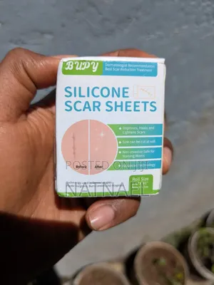 Silicon Scar Shet የጠባሳ ማጥፊያ