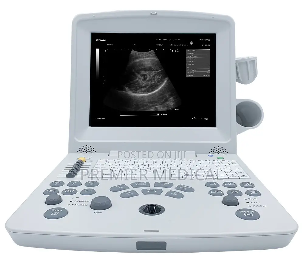 EDAN DUS60 Ultrasound Machine With Two Probes