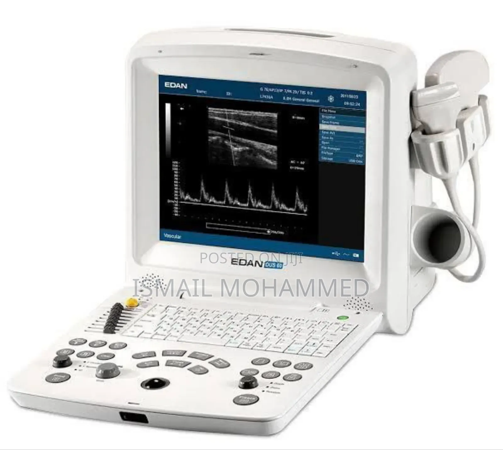 EDAN DUS60 Ultrasound Machine With Two Probes