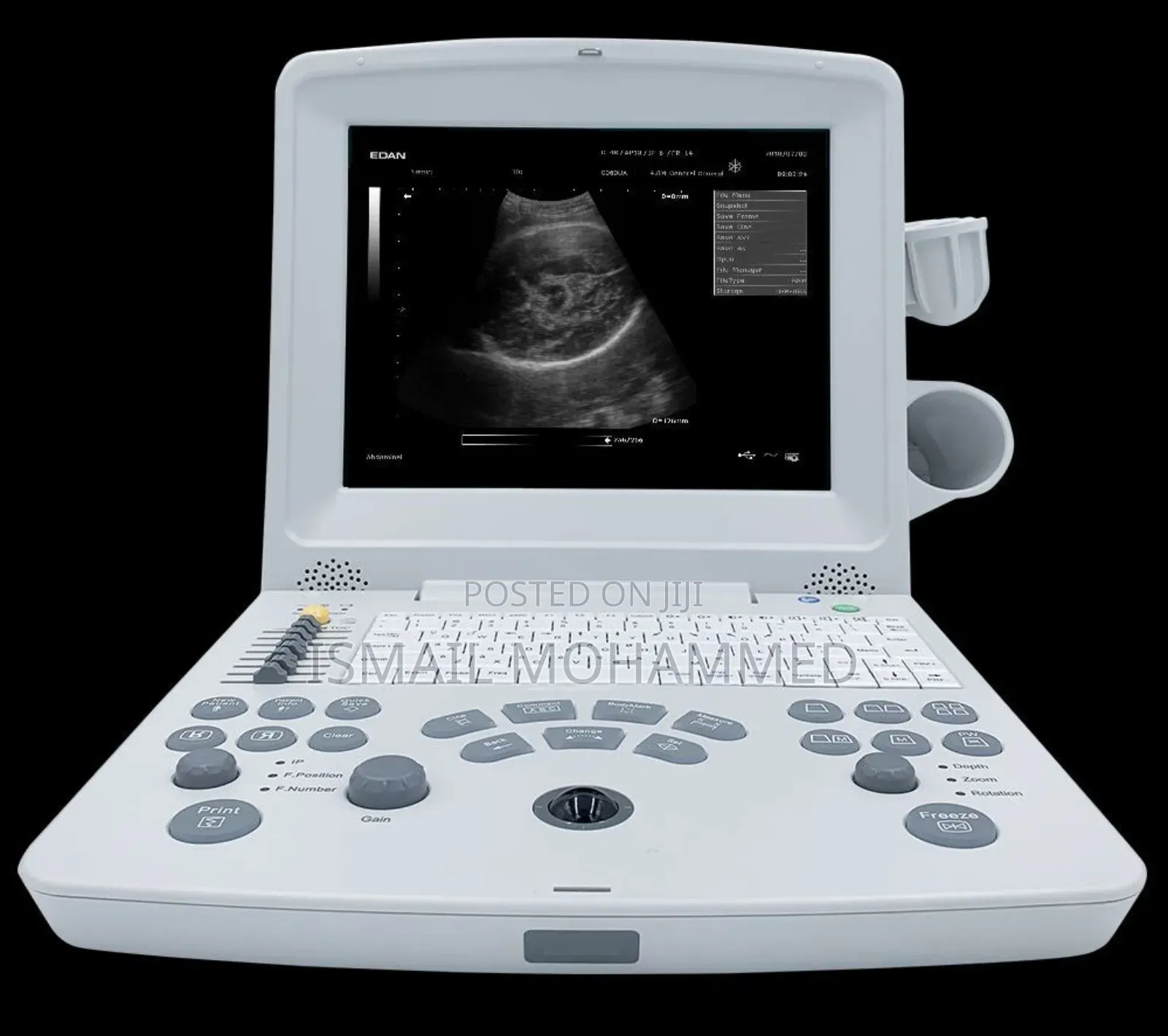 EDAN DUS60 Ultrasound Machine With Two Probes